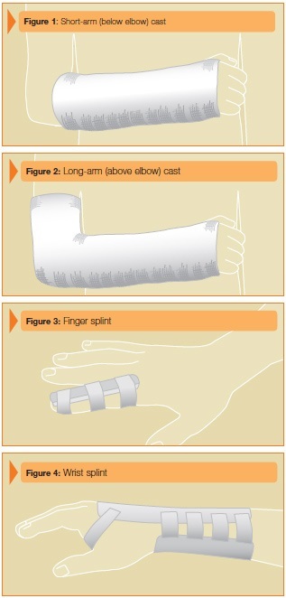 Which is Best for Your Injury: a Brace, Splint, or Cast?